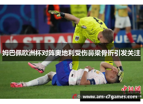 姆巴佩欧洲杯对阵奥地利受伤鼻梁骨折引发关注
